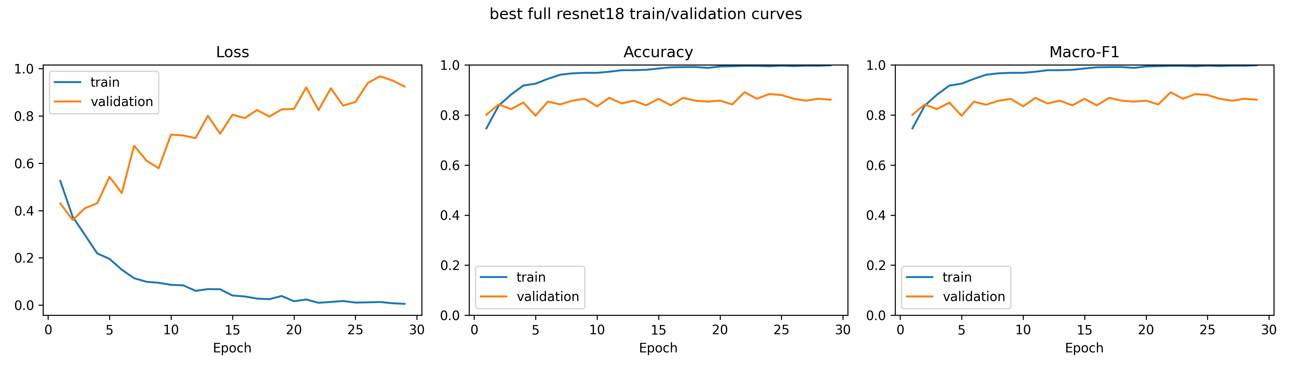 Training and validation curves for Loss, Accuracy, and Macro-F1 over 30 epochs for the best full-image ResNet18 model